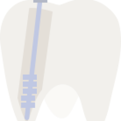 Tand-endodontologie-Villa-Westhof